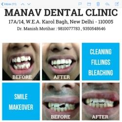 Manav Dental-Clinic
