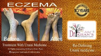 Dr.Khan Skin Clinic