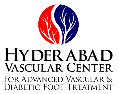 Hyderabad vascular center
