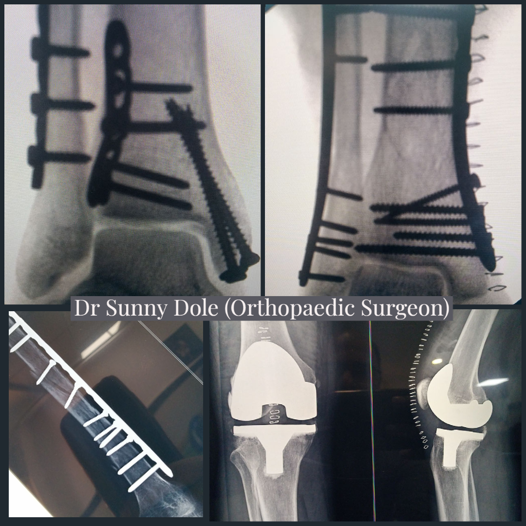 Kothrud Orthopedic Clinic