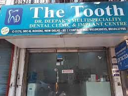 The Tooth - Dr. Deepak's Multispeciality Dental Clinic & Implant Centre