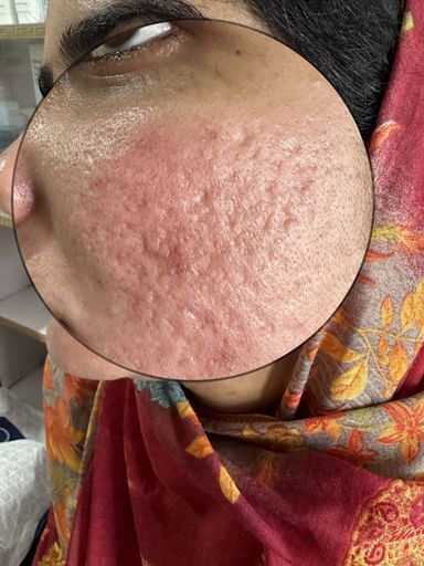 Dr. Bhats Skin Laser Hair clinic