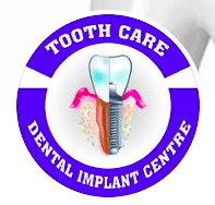 Tooth Care Dental Implant Centre