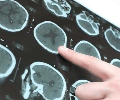 Neuro Care Centre