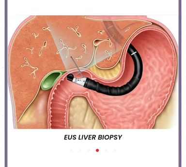 Gastro liver & IBS