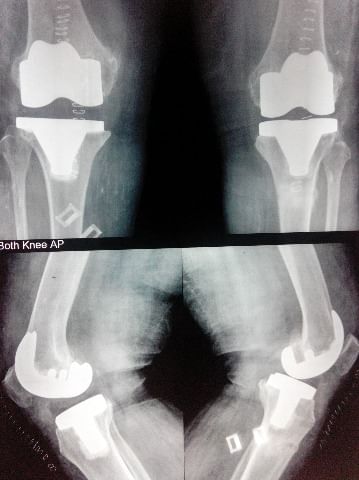 Singla Advanced Orthopedics, Knee, Hip  & Dental Hospital