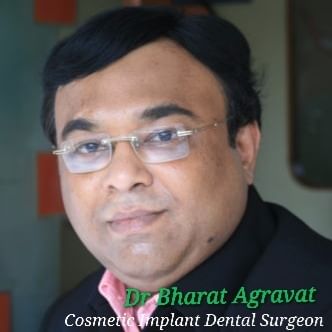 Bharat Agravat