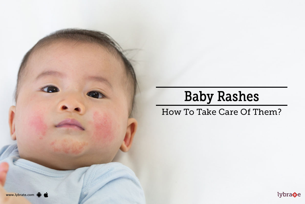 Baby Rashes - How To Take Care Of Them?