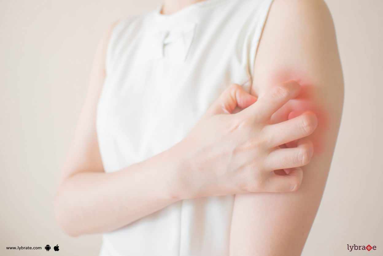 Skin Rashes - Can Homeopathy Help?