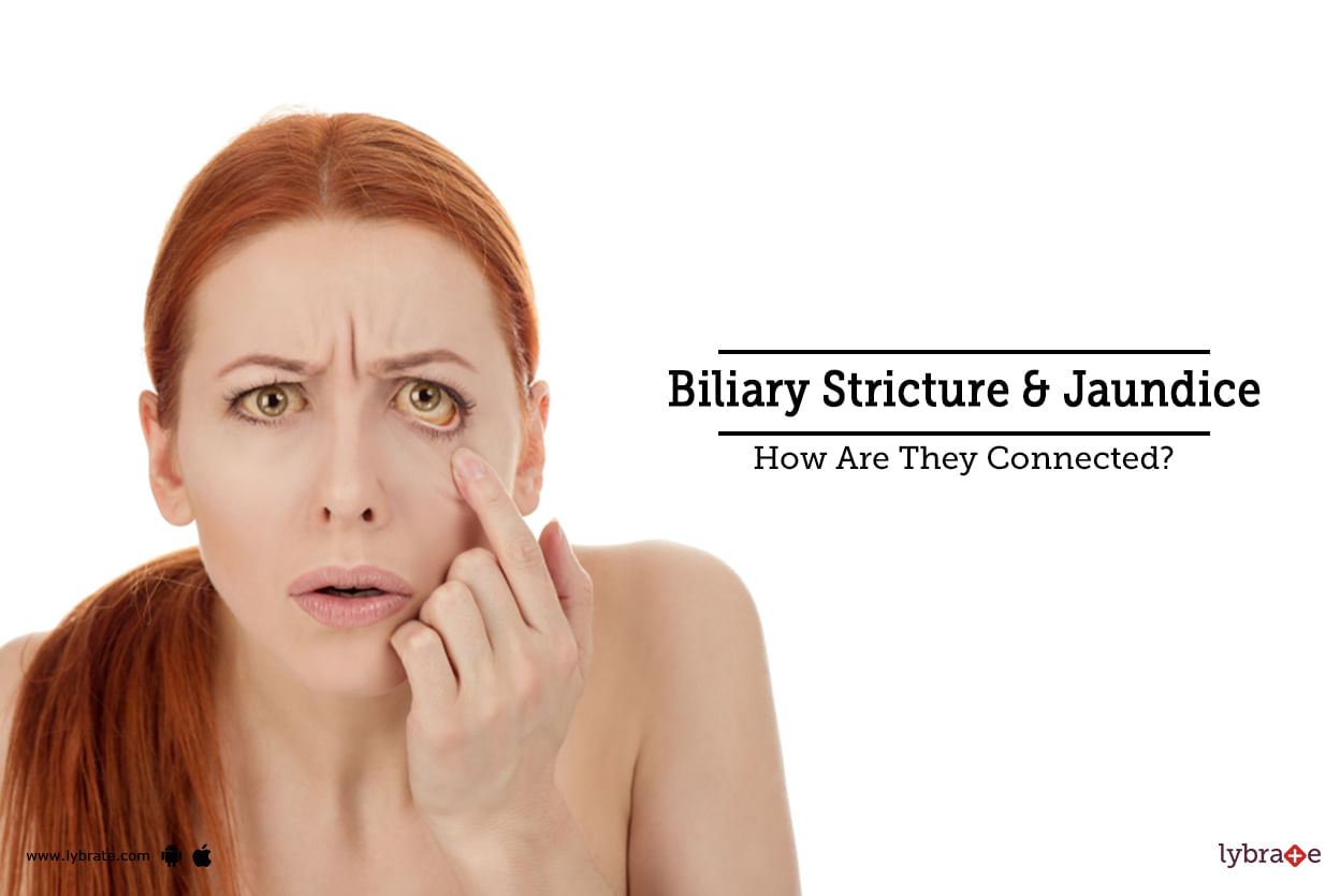 Biliary Stricture & Jaundice - How Are They Connected?