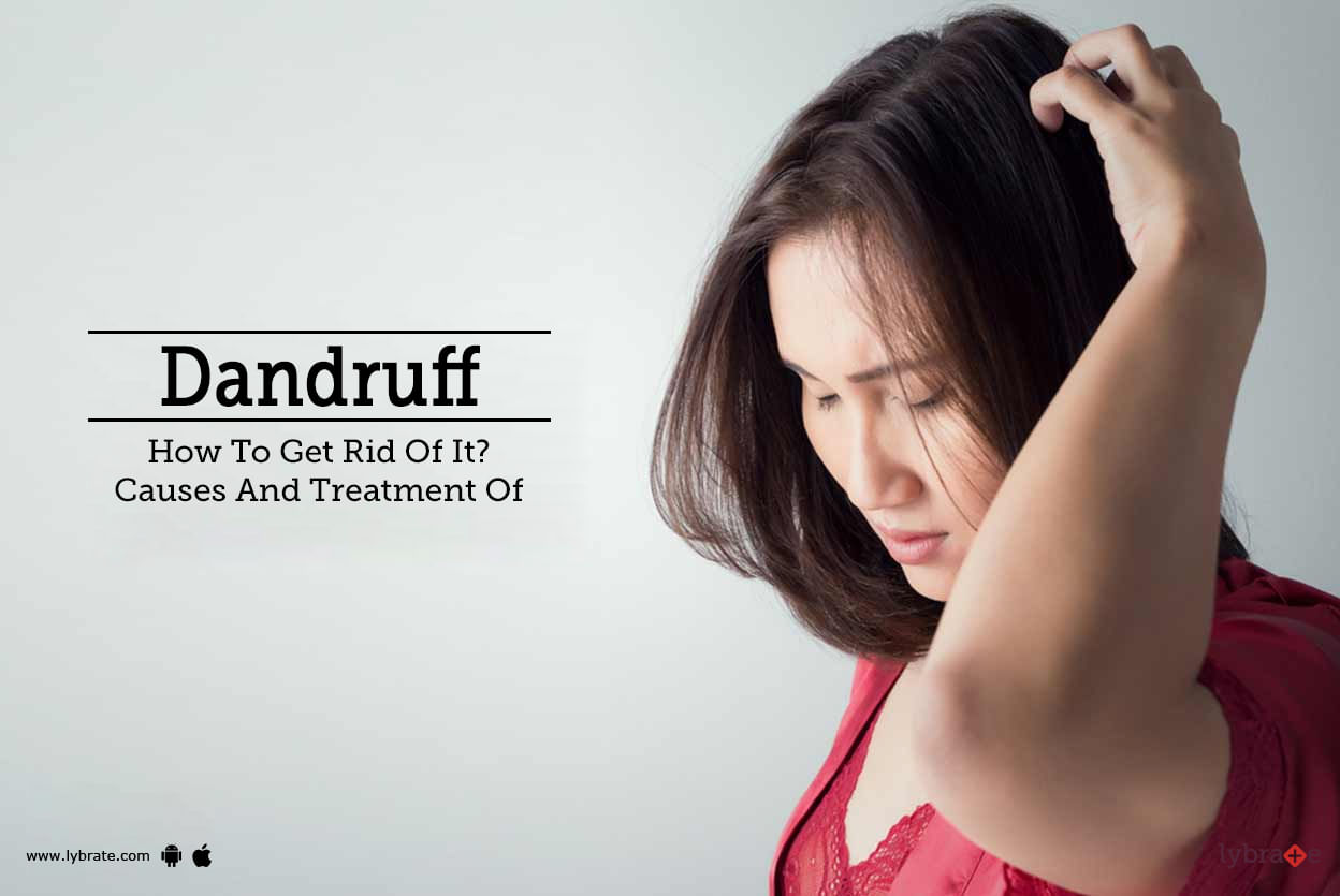 Dandruff - How To Get Rid Of It?Causes And Treatment Of
