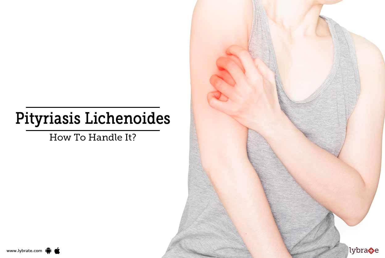 Pityriasis Lichenoides - How To Handle It?
