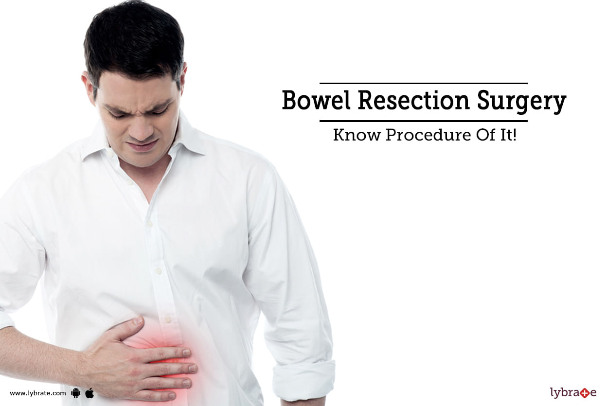 Bowel Resection Surgery - Know Procedure Of It!