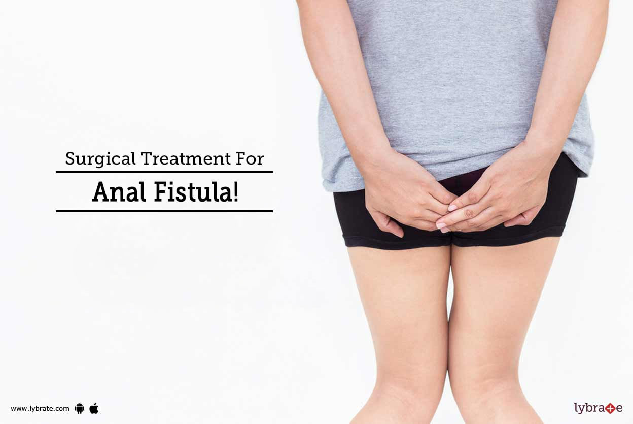 Surgical Treatment For Anal Fistula!