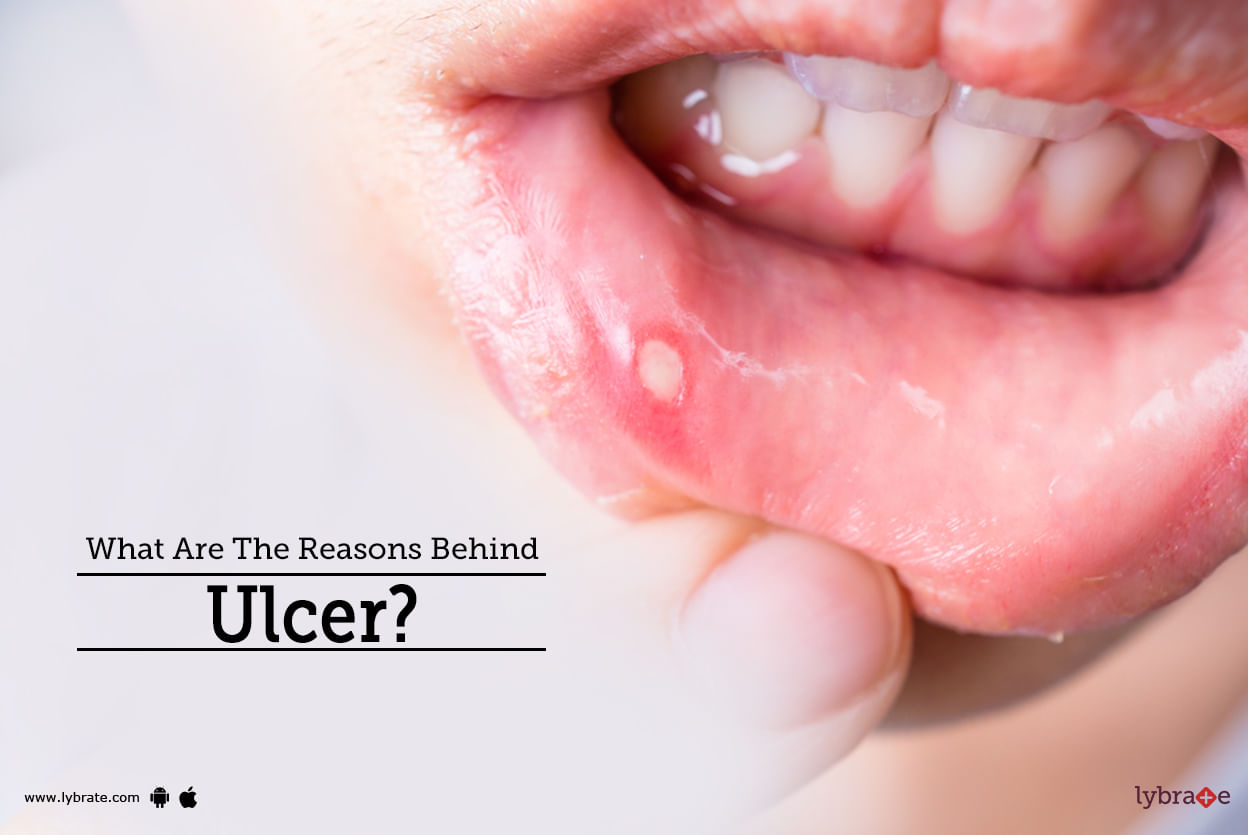 What Are The Reasons Behind Ulcer?