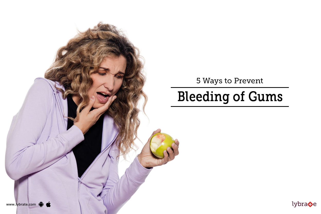 5 Ways to Prevent Bleeding of Gums
