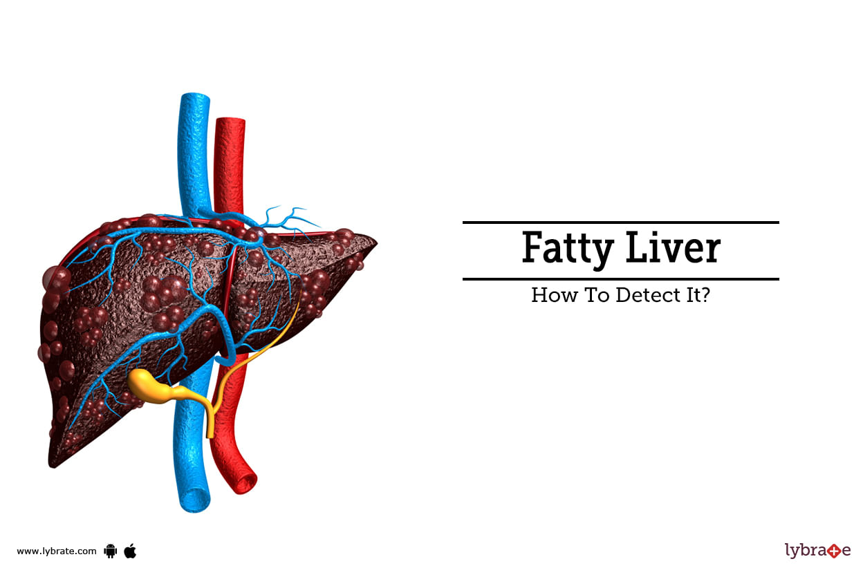 Fatty Liver - How To Detect It?