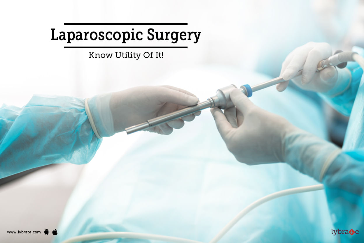 Laparoscopic Surgery - Know Utility Of It!
