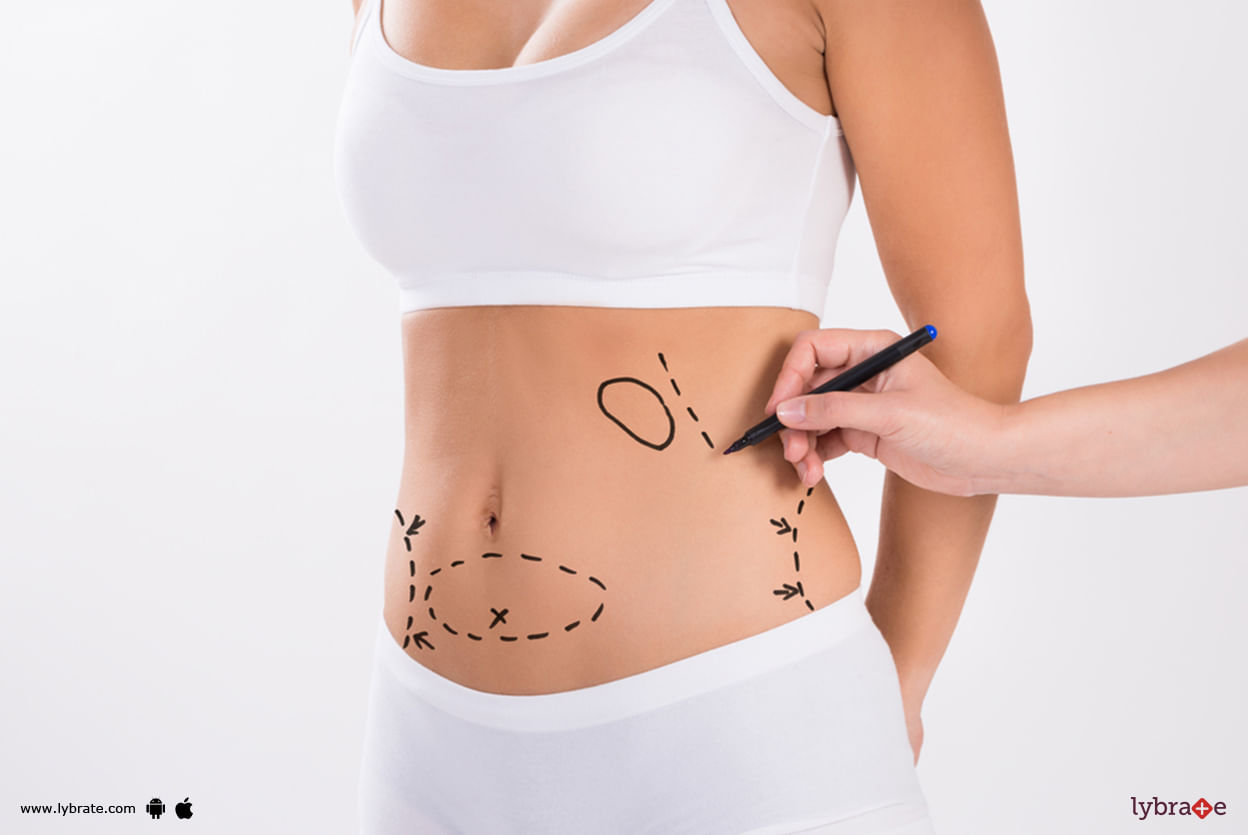 Common Liposuction Techniques - Which One Should You Prefer?