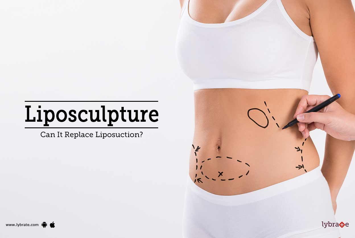 Liposculpture - Can It Replace Liposuction?