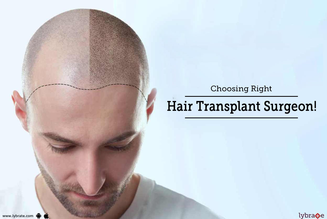 Choosing Right Hair Transplant Surgeon!