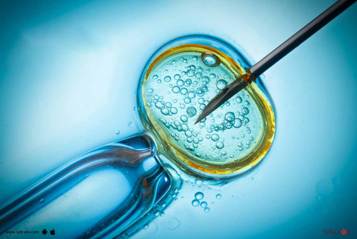 Know More About Frozen Embryo Transfer & Its Complications!