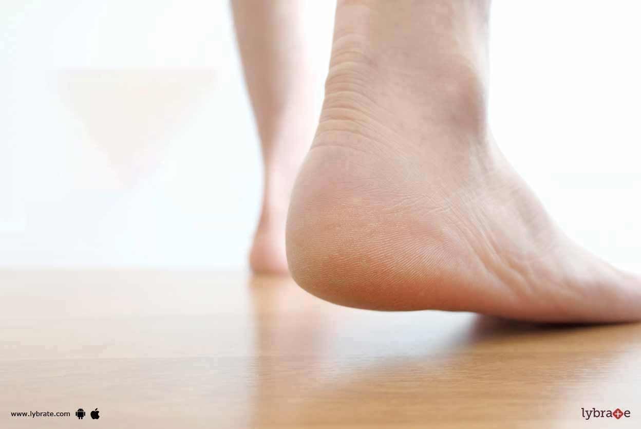 Plantars Fasciitis - How To Tackle It?