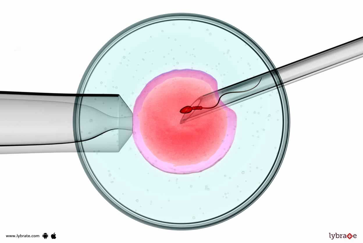 How Does The Donor Egg IVF Program Work?