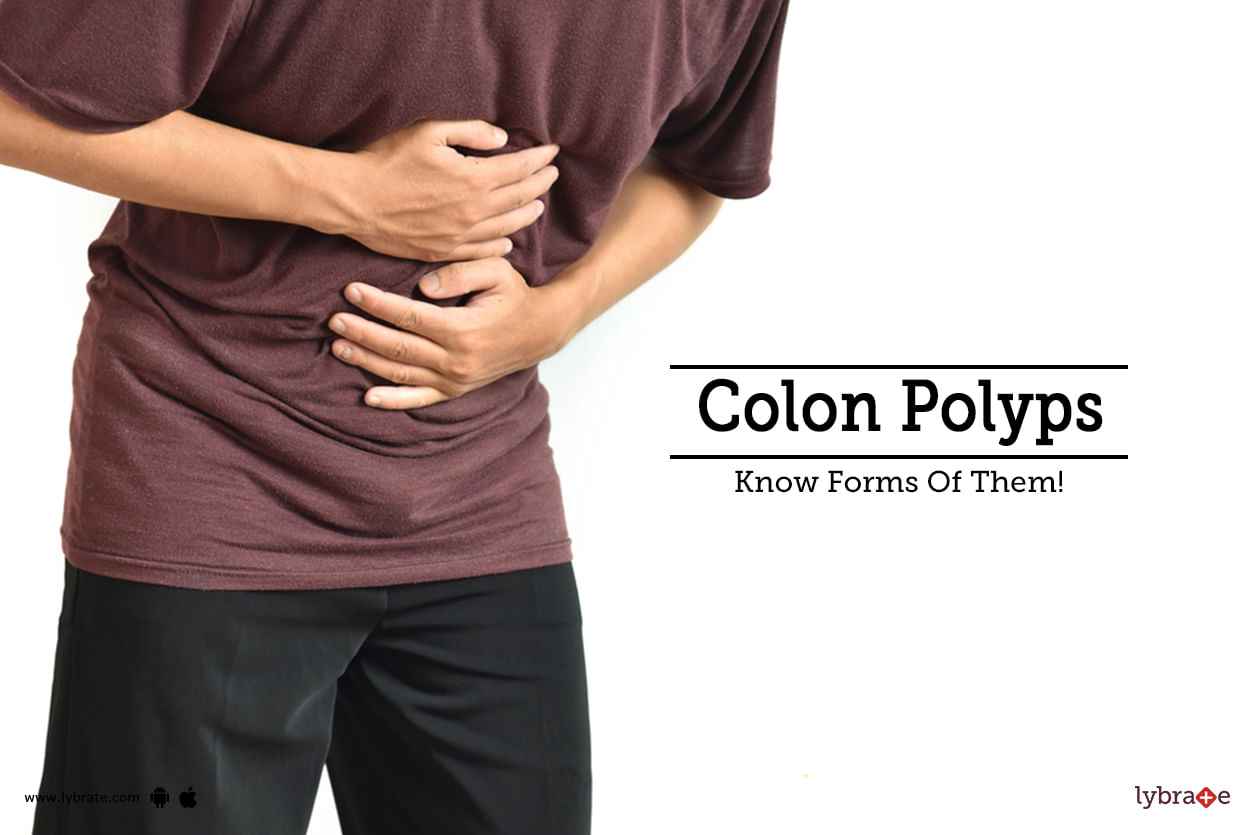 Colon Polyps - Know Forms Of Them!
