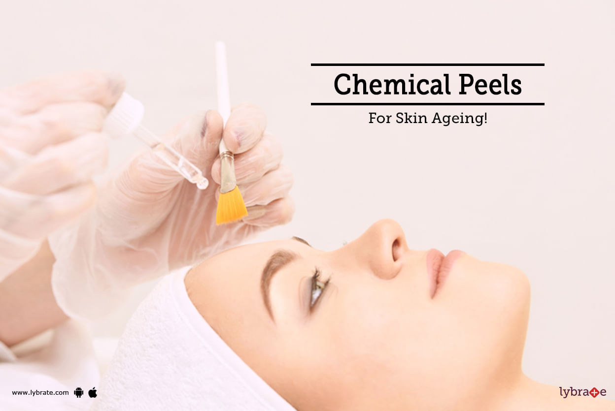 Chemical Peels For Skin Ageing!