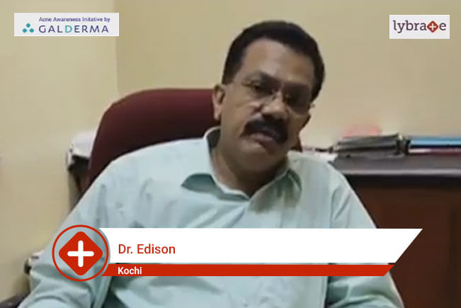 Dr. Edison speaks on IMPORTANCE OF TREATING ACNE EARLY 