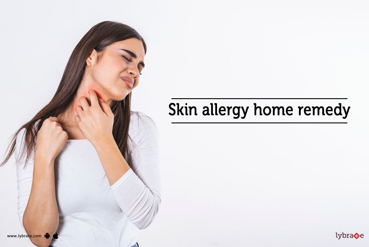 Skin allergy home remedy