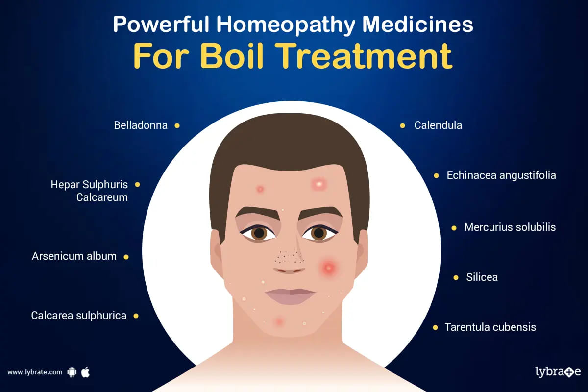 Uncover the Power of Homeopathy for Boil Treatment