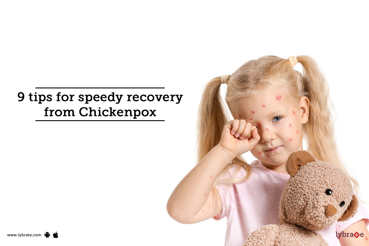 9 tips for speedy recovery from Chickenpox