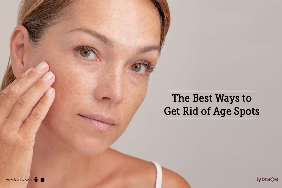 The Best Ways to Get Rid of Age Spots