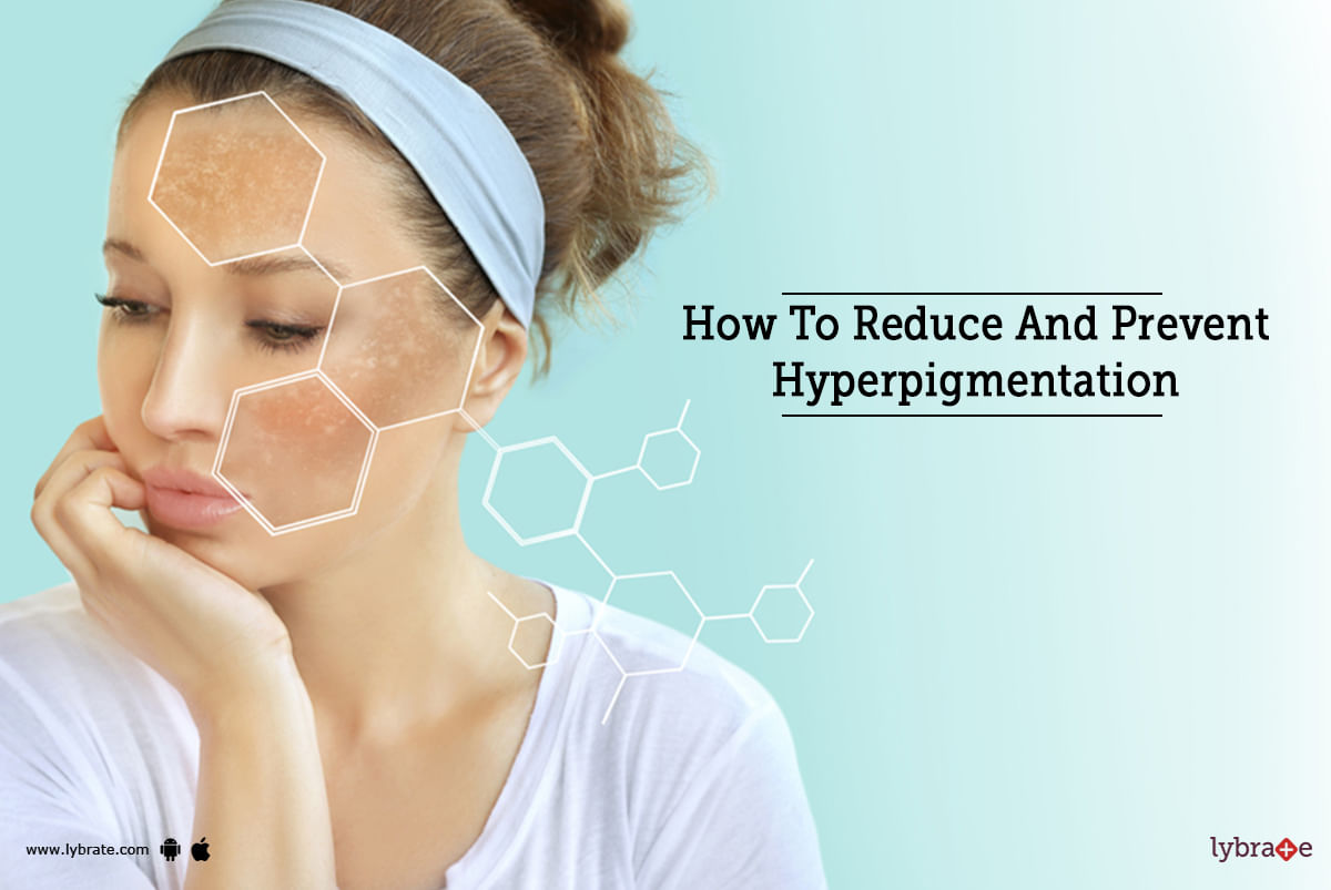 How To Reduce And Prevent Hyperpigmentation