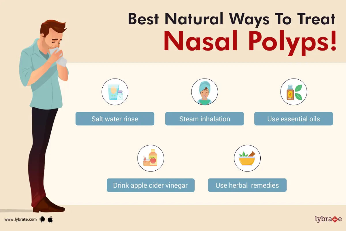 Treating Nasal Polyps at Home with Natural Treatments