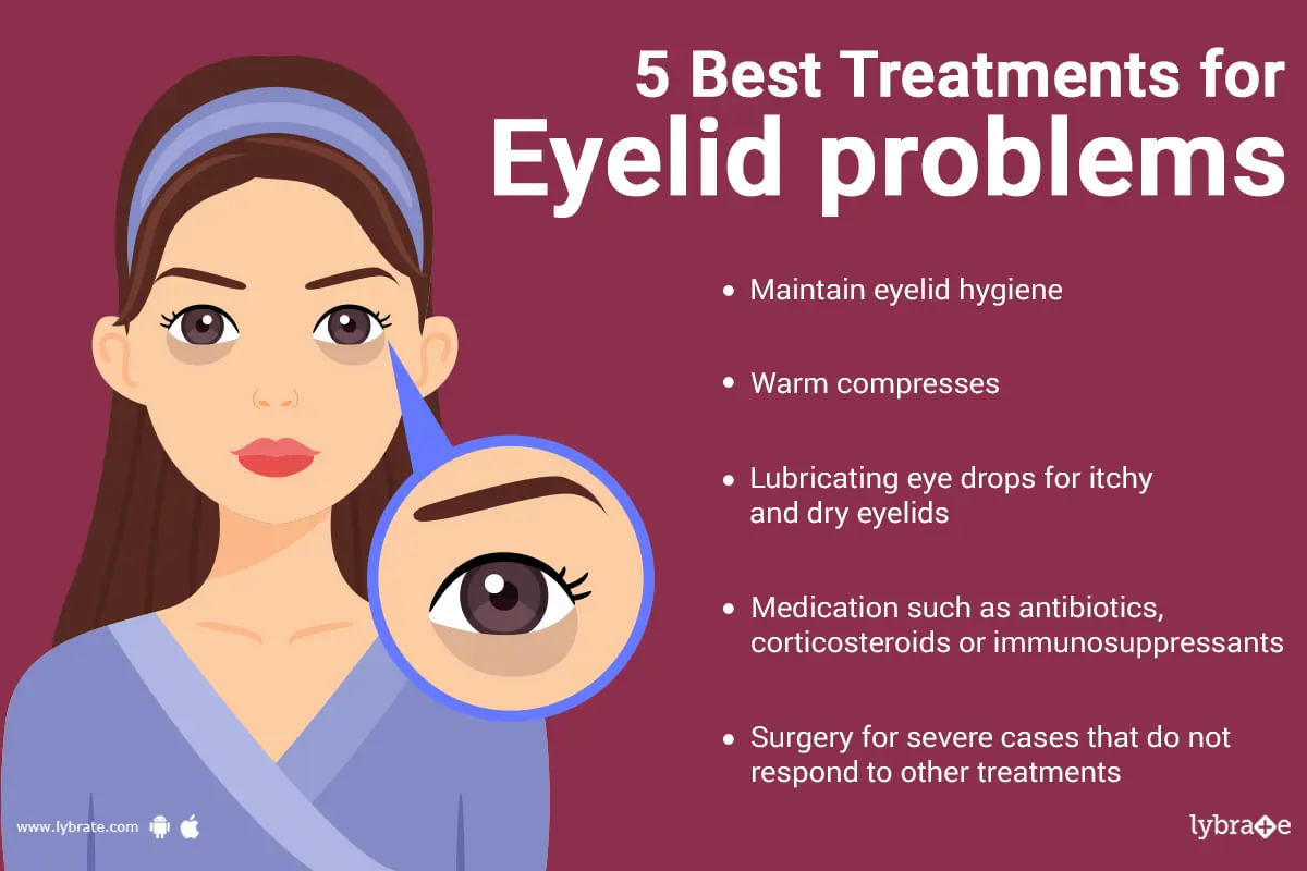Eyelid Problems - Sings, Complications, Causes and Treatment