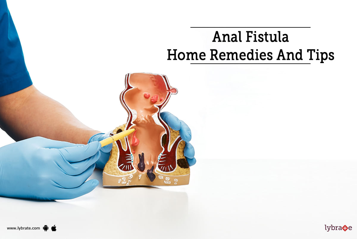 Anal Fistula Home Remedies And Tips