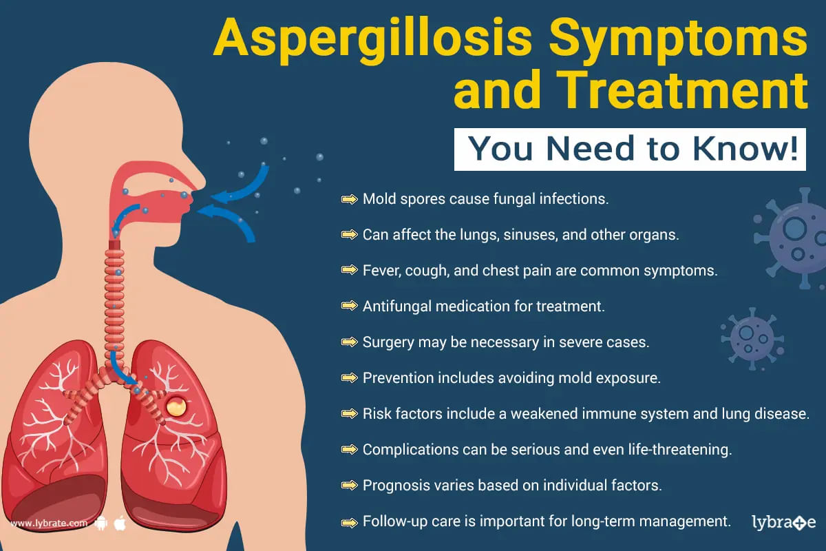 Aspergillosis: Signs, Causes and Treatment