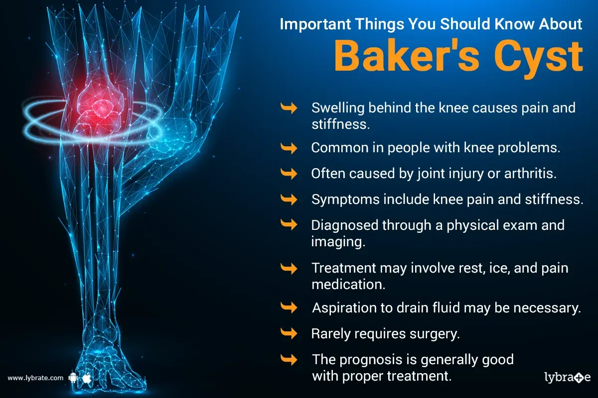 Baker Cysts Symptoms Causes And Treatment Options By Dr Mohit Madan Lybrate 0974