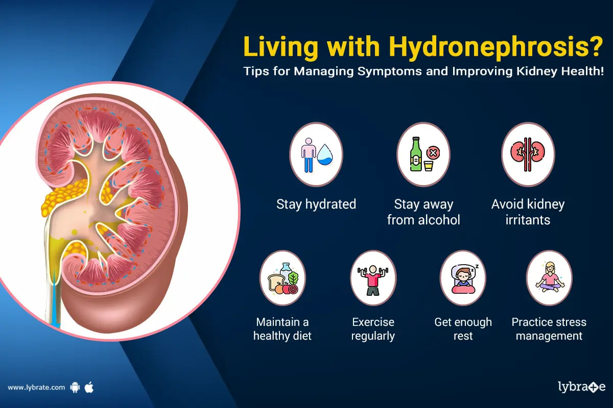Hydronephrosis: Causes, Diagnosis, Treatment and Prevention
