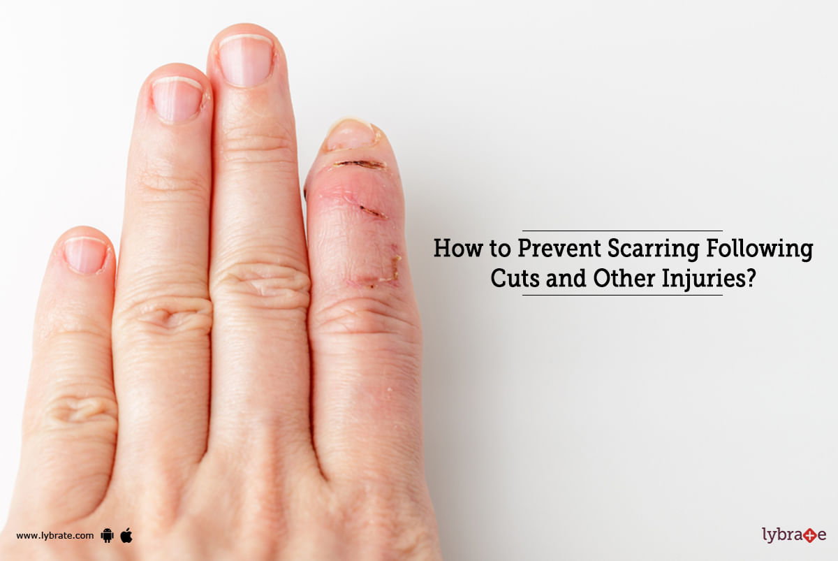 How to Prevent Scarring Following Cuts and Other Injuries?