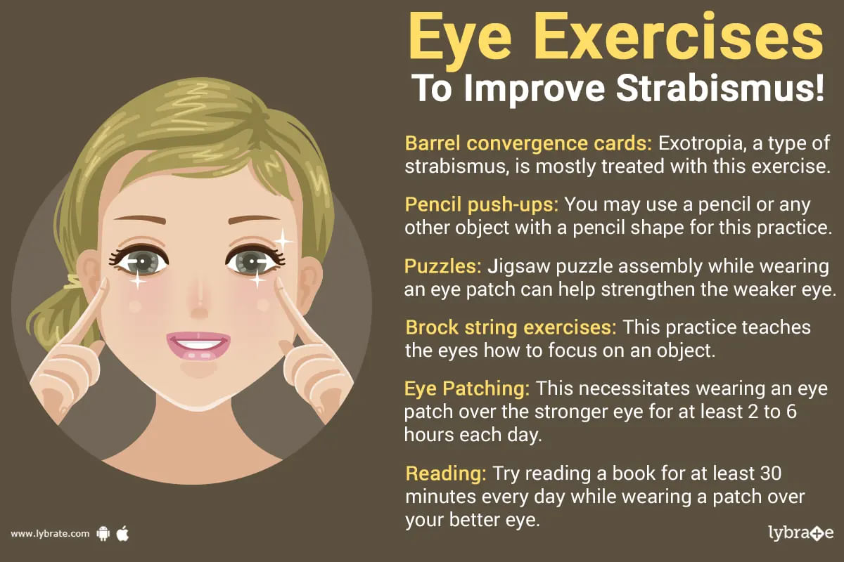 Eye Exercises for Strabismus