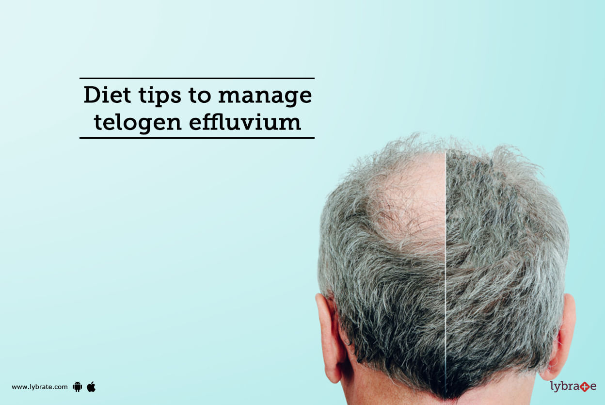 Diet tips to manage telogen effluvium