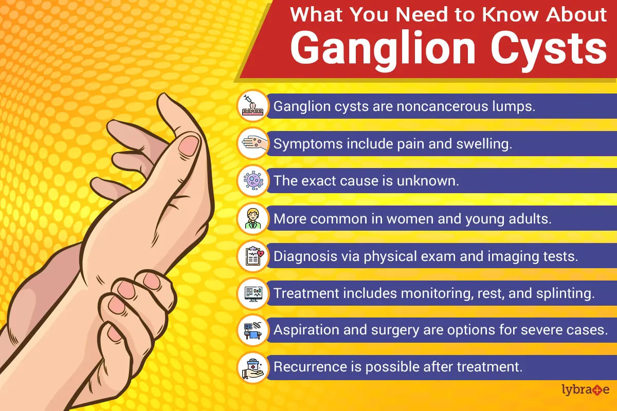 Ganglion Cyst: Symptoms, Causes, Risk-factors, Diagnosis and Treatment