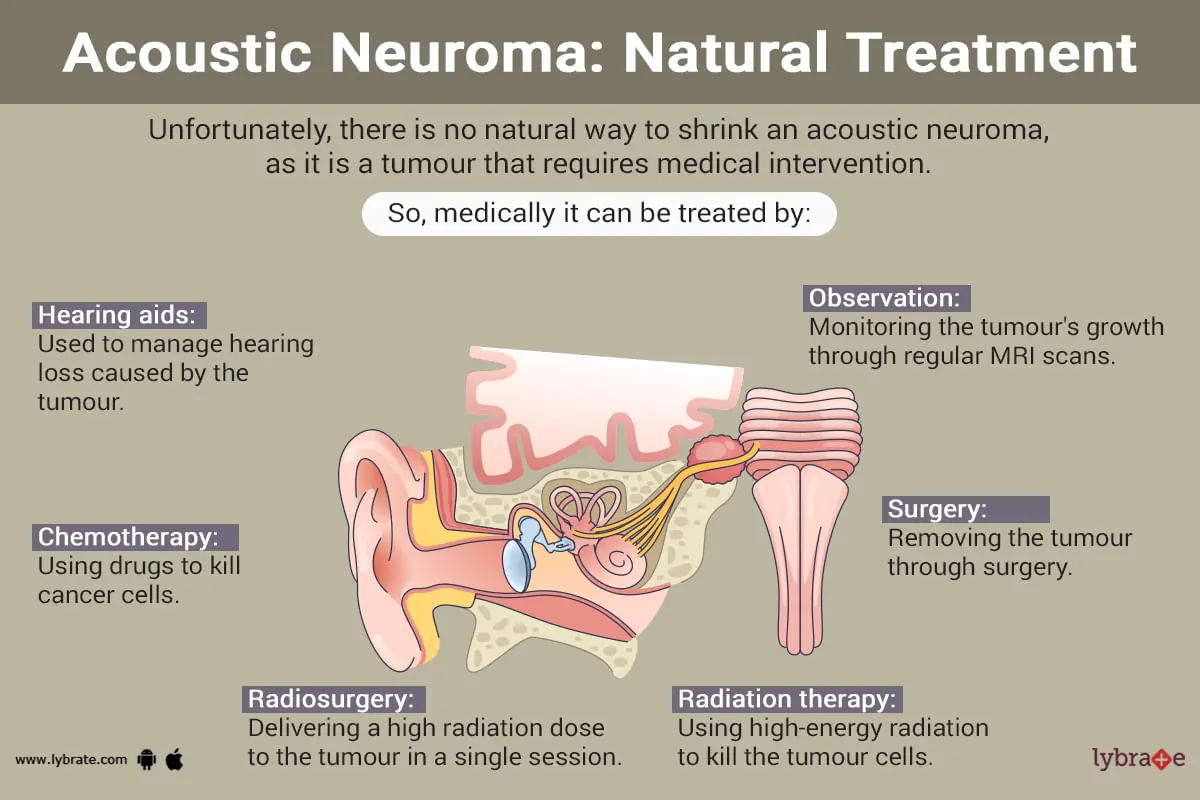 Can I Shrink an Acoustic Neuroma Naturally?