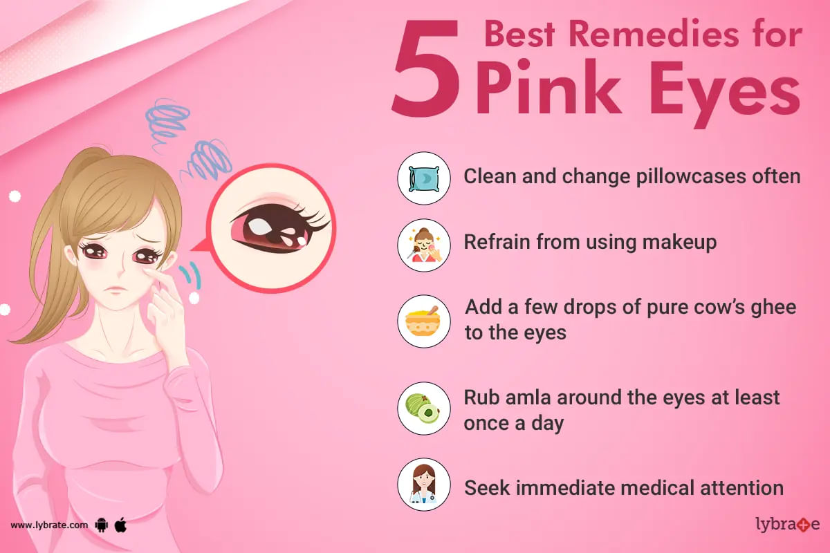 Quick Home Remedies for Conjunctivitis (pink eye)