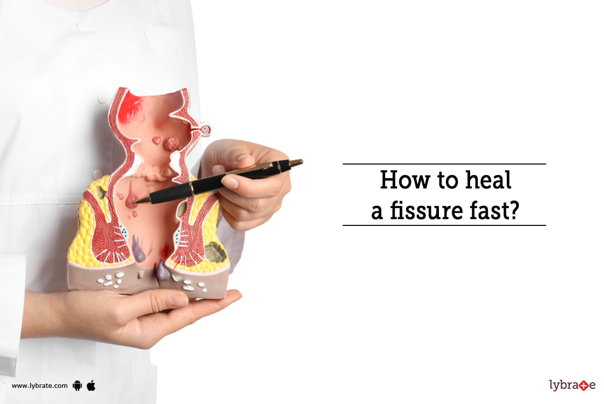How to heal a fissure fast?