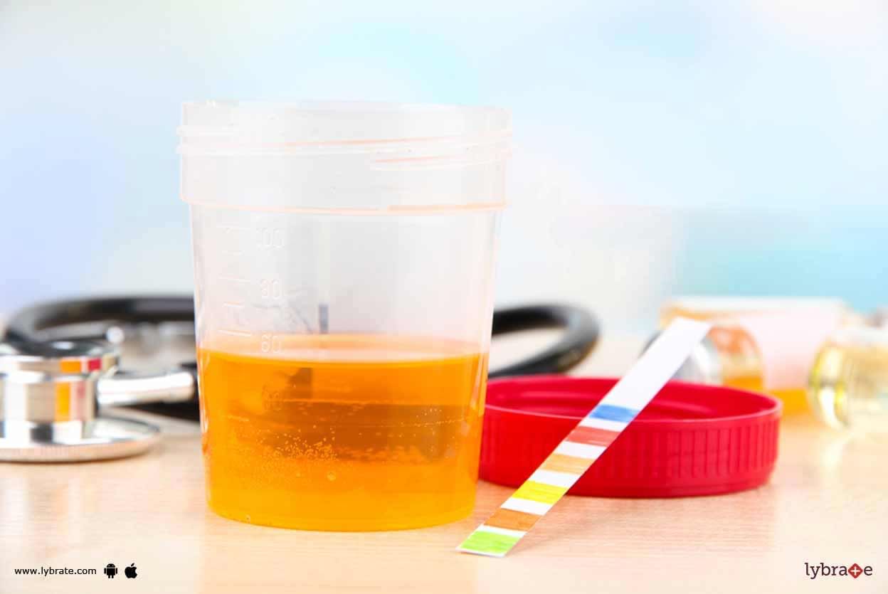 Red Colored Urine - Can It Be A Sign Of Urinary Tract Infection?